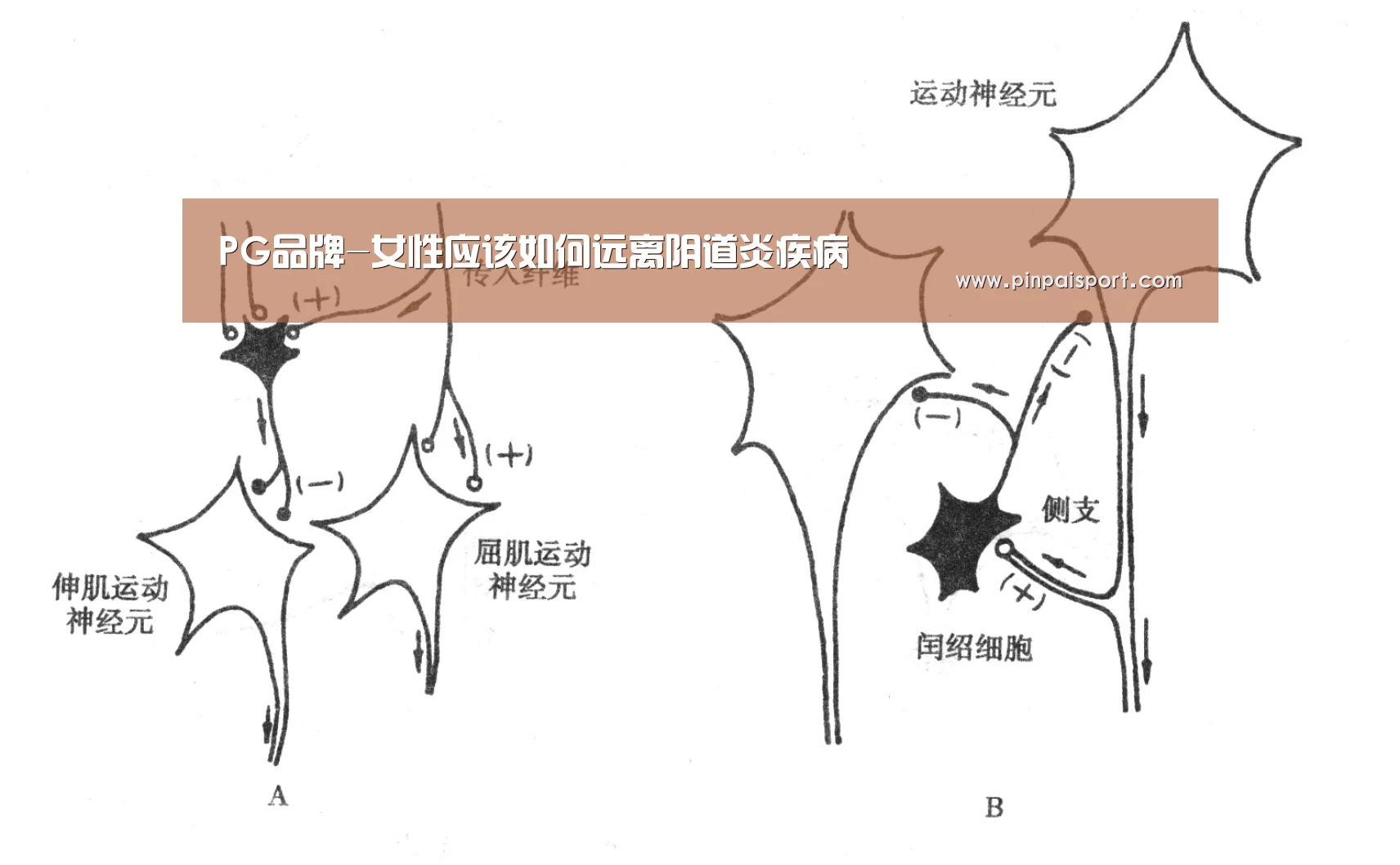 PG品牌-女性应该如何远离阴道炎疾病(图2) PG品牌